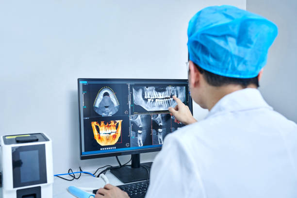 Best Emergency Root Canal Treatment in Nokomis, FL